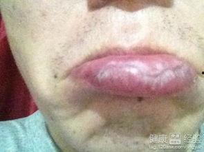 吃角瓜舌头痒,吃角瓜引发的神秘瘙痒之谜